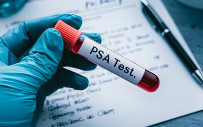 PSA Τιμές: Ποιες Είναι οι Φυσιολογικές Τιμές και Πότε Χρειάζεται Έλεγχος;